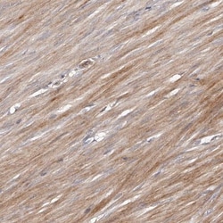 URG4 Antibody, Novus Biologicals 0.1mL; Unlabeled:Antibodies, Polyclonal